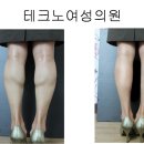 울트라 v 리프팅 전문 시술 병원임니다.. 이미지