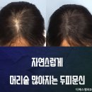 디에스가발