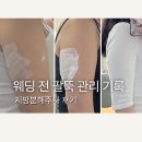 하프의원 | 강남 지방분해주사 후기ㅣ하프의원 신사 팔뚝·뱃살 5주 비포에프터 (내돈내산)