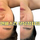 분당 정자동 피부관리 탄력 전문 엔비스킨에서 10살 어려지세요