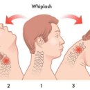 안성자연한의원 이미지