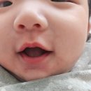 조숙헤어라인 | [육아]침독과 머리핀(4개월아기,쁘리마쥬,초미니헤어핀,머리숱없는아기)