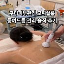 양원장쌀롱 | 구디피부관리 모찌살롱 등여드름 관리 과정 솔직후기