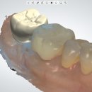 R - Dental 티스토리
