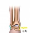 Re:삼각인대 손상 문의드려요~ 이미지
