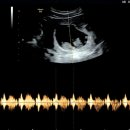 에스더산부인과의원 | 입덧 없는 임신부의 기록, 마미톡 초음파, 1차 기형아 검사, 입체 초음파, 수지미래산부인과 후기, 각도법