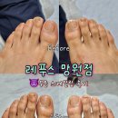 망원역(6) | 무좀 부끄러워서 방치했다가 더 심해져서 ‘레푸스망원역점’에서 케어받은 후기