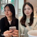 홍대전철역 1,2번출구 | 홍대입구역피부과 울쎄라피프라임 온다리프팅 후기(이중턱 박멸!)