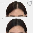 마음에점을찍다제주점 | 두피문신] 거울 볼 때마다 스트레스였던 정수리 탈모, '마음에 점을 찍다 광주본점'에서 극복한 솔직 후기!
