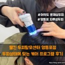 영등포우체국 앞 | 여의도 문제성두피 해결에는 웰킨 두피탈모센터 영등포점 두피케어받은 후기 (남성, 탈모, 가려움)