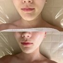 위례윤곽관리 셀럽 포토샵 효과 디유에스테틱 후기