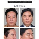 노블레스성형외과의원 이미지