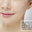 서울모아치과 이미지