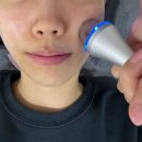 솔터로-R | [김포] 구래동 물광관리 문제성피부 초이스뷰티 후기