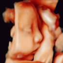 하나산전 | [공지] 미래아이산부인과 플로라테라피 산전마사지 추천 &amp; 29주차 입체초음파 후기