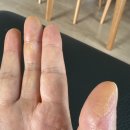 국홍일국정표피부과의원 이미지