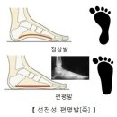 점프스쿨에코
