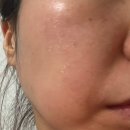 세라마인 듀얼 발란스 솔루션 에센스 토너 후기 귀찮은 날 이것 하나면 끝 피부진정 루틴 추천