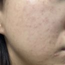 가인스킨샵 | [의정부피부관리] 스킨케어받으러 가인미가 다녀온후기