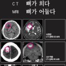 CT와 MRI의 차이에 대해서 궁금해요 이미지