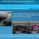 Parotid abscess with reactive lymphadenitis 이미지