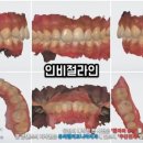 그리치과기공소 이미지