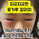 [공지] [의사가 강조한 꽃가루 알러지 비염 시즌생활 습관 3가지] 와 아로마테라피스트의 코 뻥 뚫리는...