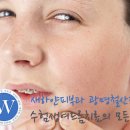 대학의료기(광명) | [철산피부과] 수험생 여드름, 광명 수험생관리로 깨끗한 피부만들기