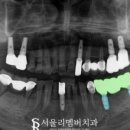 서울리멤버치과의원 이미지