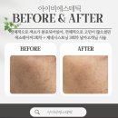 아이비에스테틱 이미지