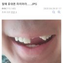 휴대폰스토리 이미지