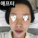 다경 | 군산 피부재생 잘하는 곳 추천ㅣ퀸다경뷰티ㅣ후기 가격
