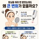 미인토닝클리닉 | 토닝 20번 했는데도 기미가 남아있다면? 놓치고 있는 원인