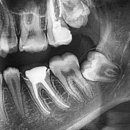 안아파치과의원 이미지