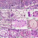 점액포자충 Hoferellus carassii감염 금붕어 신장종대증(kidney enlagement disease, KED) 이미지