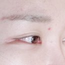 ✨ 다크브라운 C컬 연장 시술 후기 – 모량 부족 케이스 전문 시술