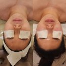 천안 쌍용동 이화 에스테틱에서 웨딩 케어를 위한 윤곽관리 받았어요.