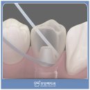 맥치과기공소 이미지