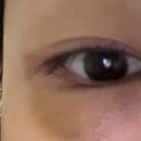 케이멍 | 멍크림) 눈탱이 밤탱이크림/ 멍크림 /스킨테라피 아르니카케이 리커버리크림 멍크림 후기/멍빼는방법!