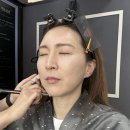 티엘헤어라인 이미지