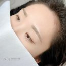 아인뷰티의원 이미지