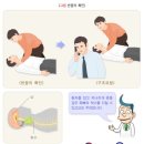 심폐소생술[cardiopulmonary resuscitation ] 이미지