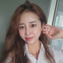 얼굴 실리프팅후기 전후 차이 비교 및 민트실 붓기