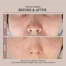 메디컬한의원 | 인천 송도 모공이 차오르는 마법 후기! 고민없이 메디컬오한의원