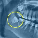 동탄가온치과의원 이미지