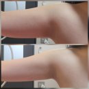 단정로 | 창원 웨딩관리 추천, 탐날에스테틱 창원점 후기
