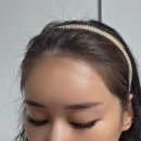 이마 | 강남역피부과 이마필러 후기 내돈내산 전후, 멍, 유지기간, 통증까지 총정리 ㅎㅎ