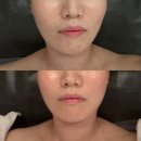 사하구-14 | 하단바디관리 ‘퓨어스킨앤바디 하단점’ 사하구 에스테틱 리프팅 후기