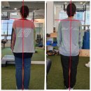 CST 2회만에 이렇게 된다고??? 몸이 얼굴에 미치는 영향