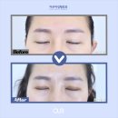 아우어성형외과의원 이미지